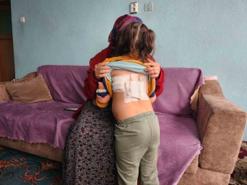 Evinin önünde oynayan çocuğa eşek saldırdı; o anlar kamerada (2)